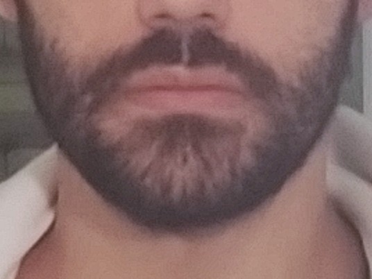 IMG 20200731 0905352