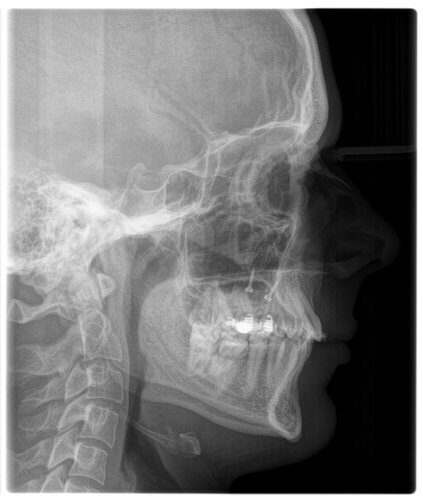 Sidexray.JPG