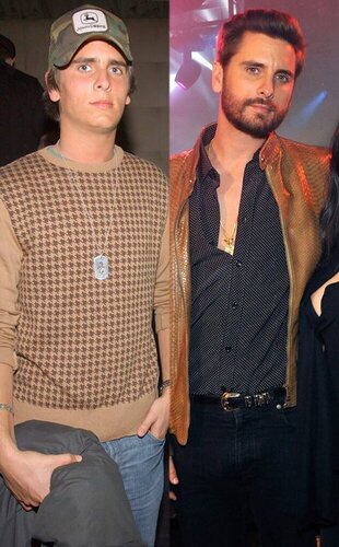 rs_634x1024-150318092035-634-scott-disick-before-after.ls.31815.jpg