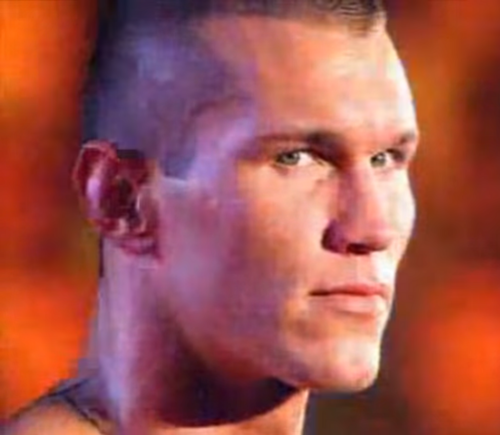 ORTON