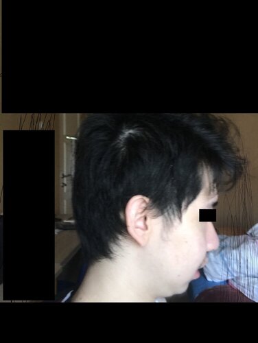 very_bad_side_profile.jpg