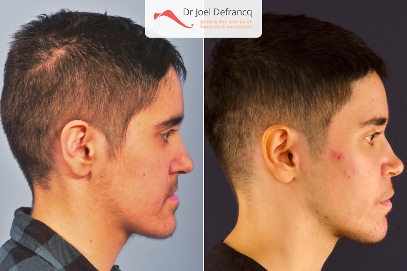 Dr Joel Defrancq 1534581639067992400 5787 4