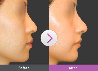 Screen Shot 2016 02 18 at 23355 PM