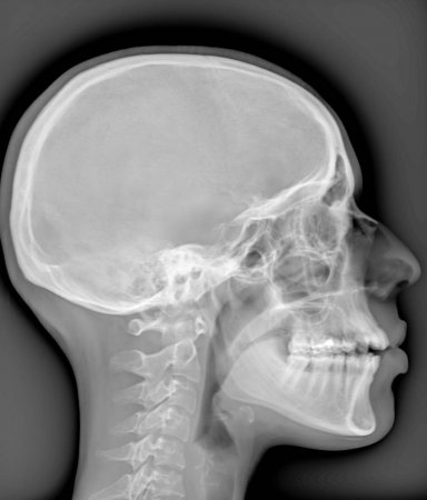 Depositphotos 303713092 stock photo diagnostic head x ray film