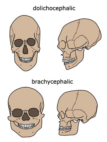 Skullscomparison