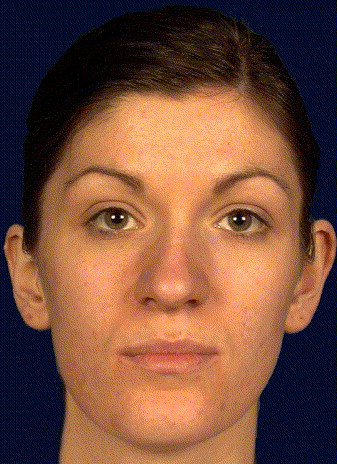 1 s20 S0266435605000392 gr3 1