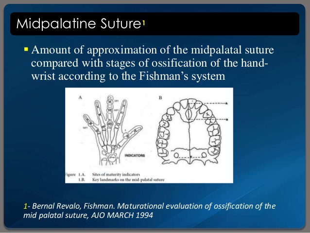 Skeletal age assessment 34 638