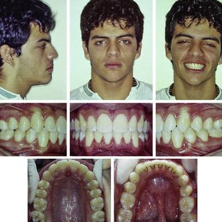 Posttreatment photographs Q320