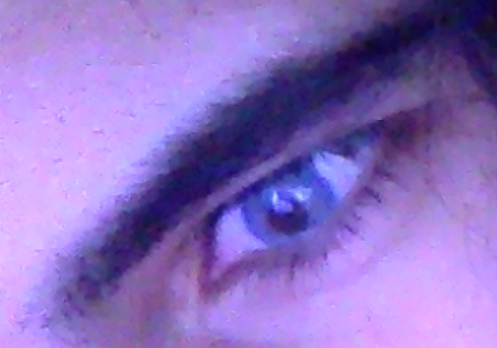 Eye1