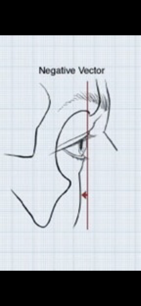 BFA0CD11 B829 46A4 BD13 339DD8E2B748