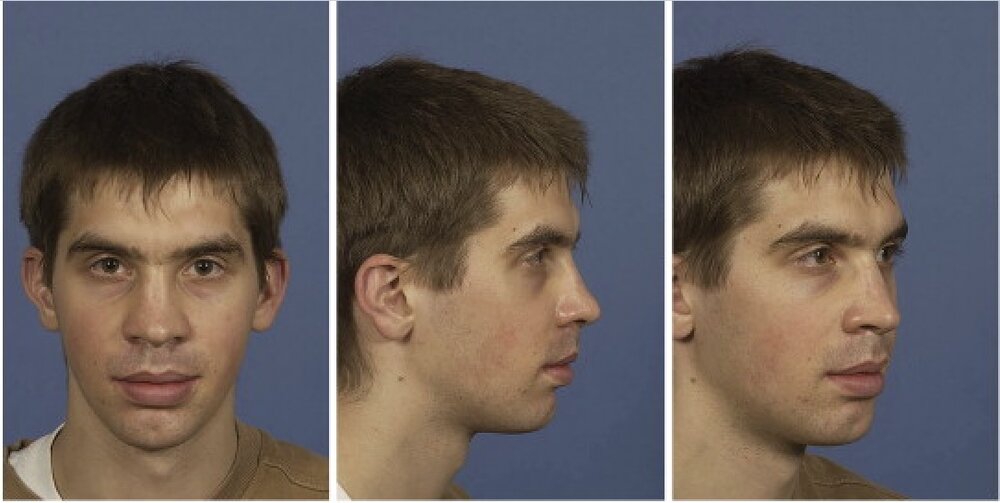 Eb0vjBu 1