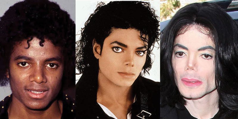 Michael jackson plastic surgery before and after