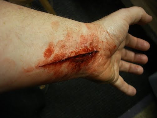 Slit 5