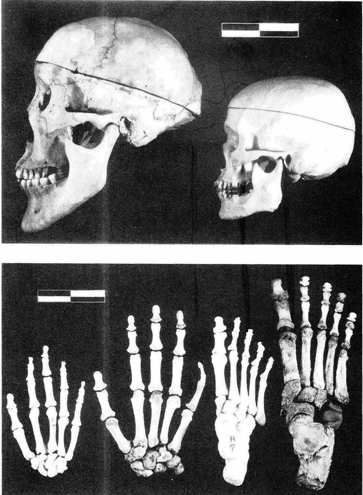 E2362c13d36c2df865722f66bd9c2ee9  skull and bones anatomy