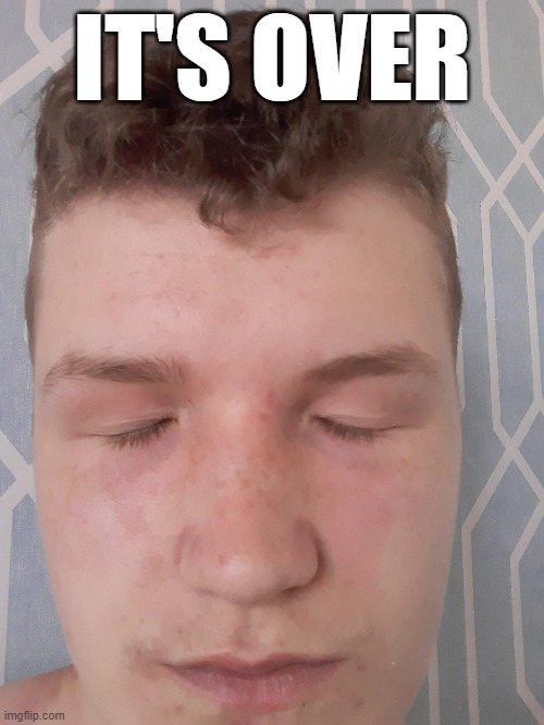 ITSOVER
