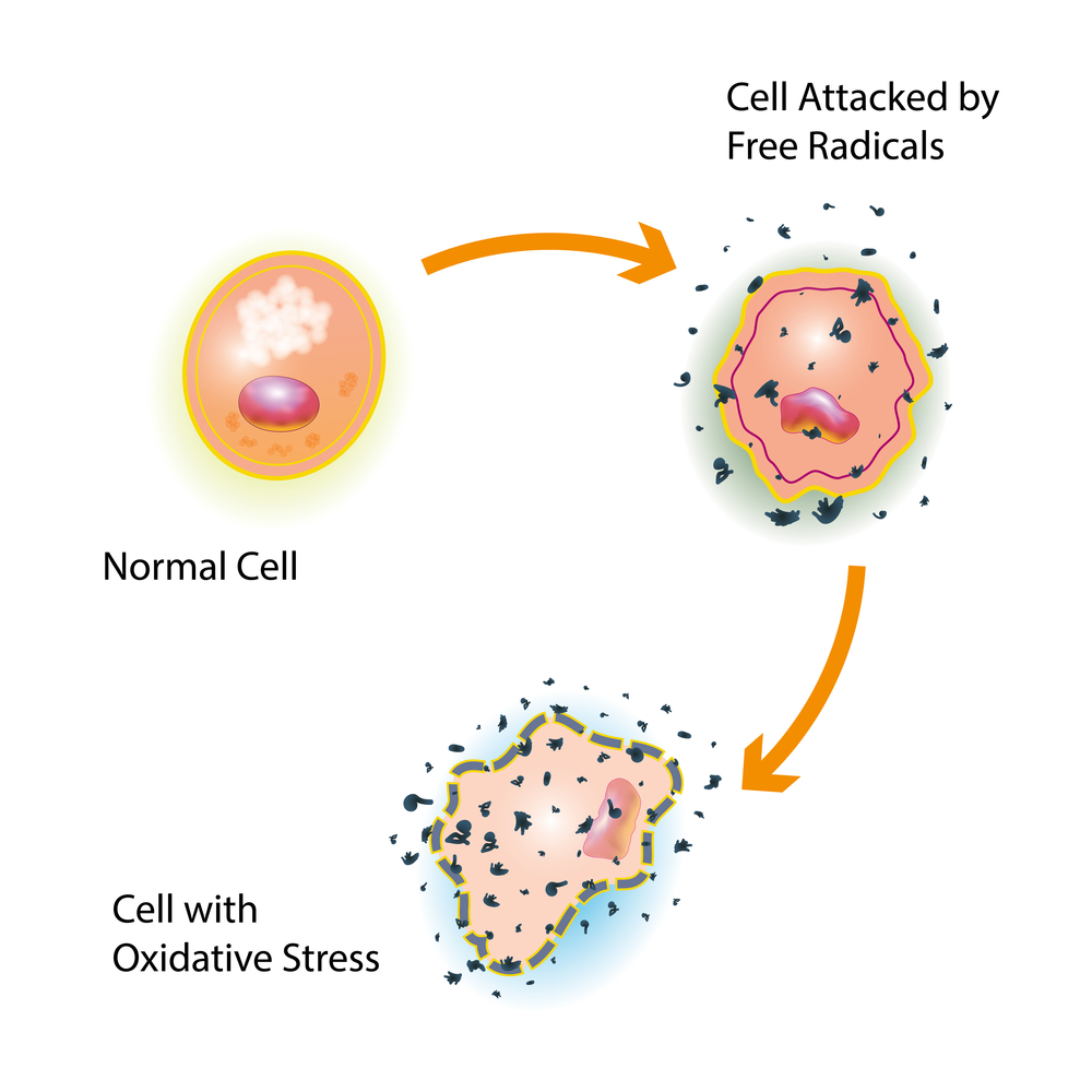 Freeradicals 