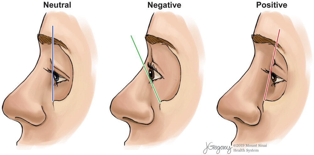 Hed26015 fig 0002 m
