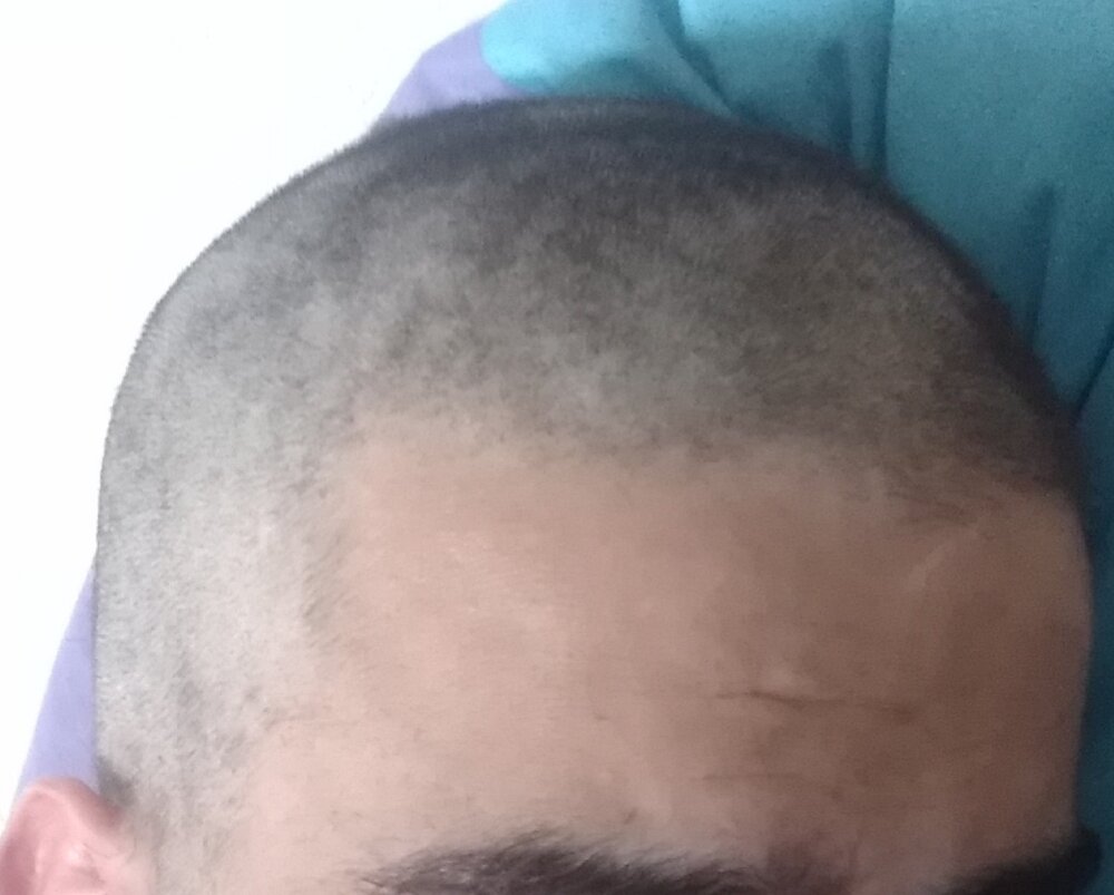 IMG 20200814 170533