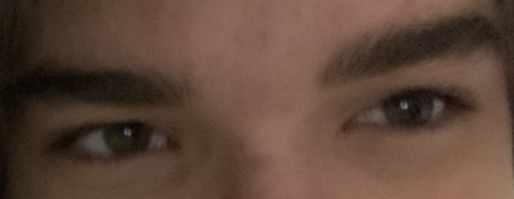 Eyearea