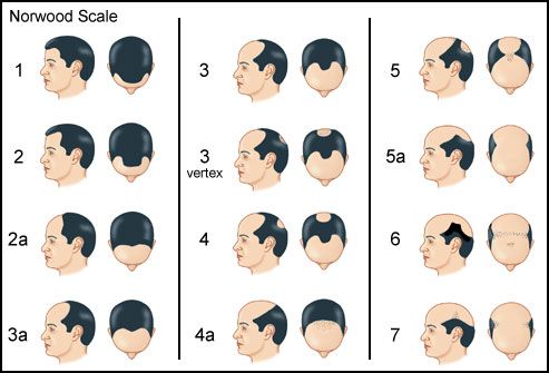 A5BE8EBA 408E 4CB6 85CC 69F08979DEAB