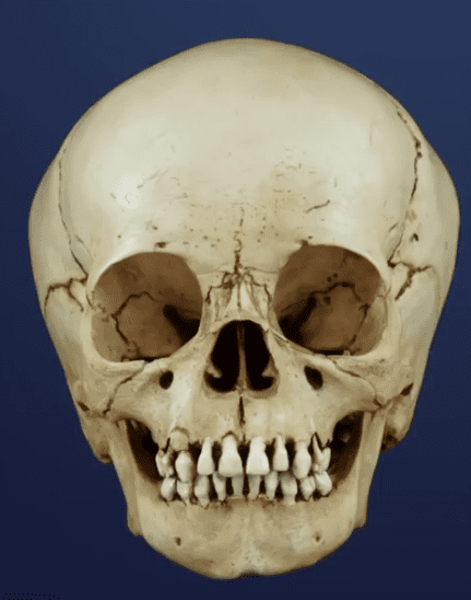 Badskull