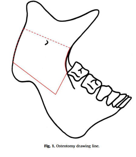 1597598690558