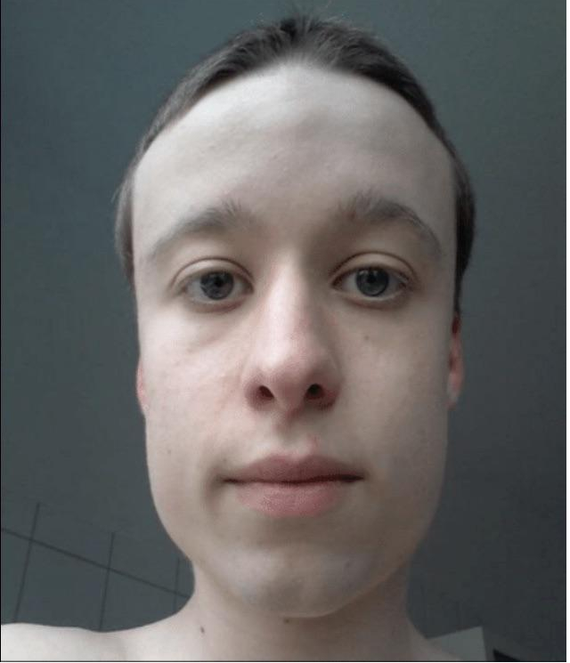 Xd