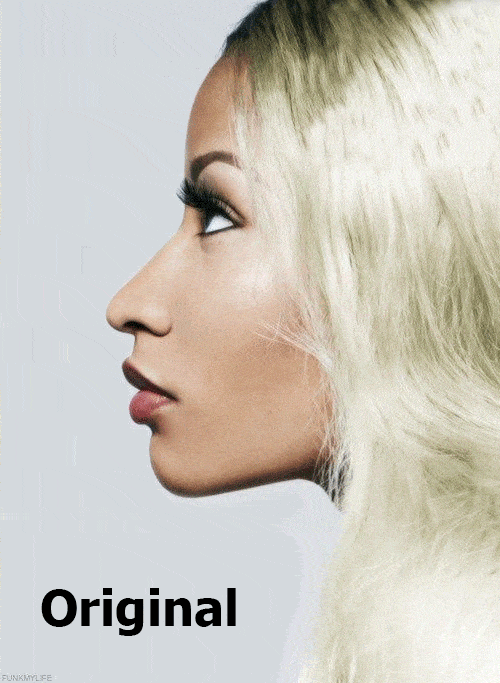 Forward growth of the eyes