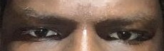 Eye area