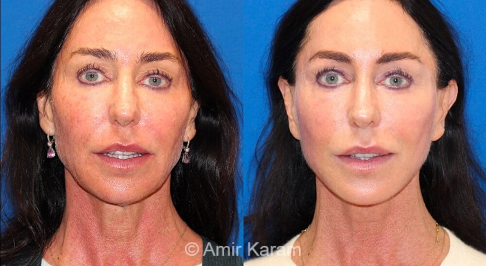 Screenshot 20200819 153540