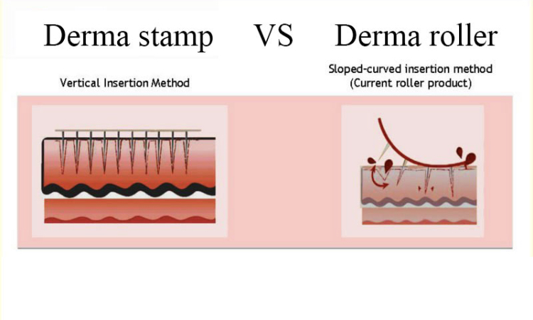 B11313B1 BE43 46D8 BE96 9D481E9110F7