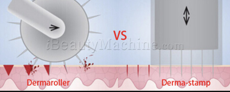 BA8F4F87 AD9A 433C 94AB 7AFB405A24EB