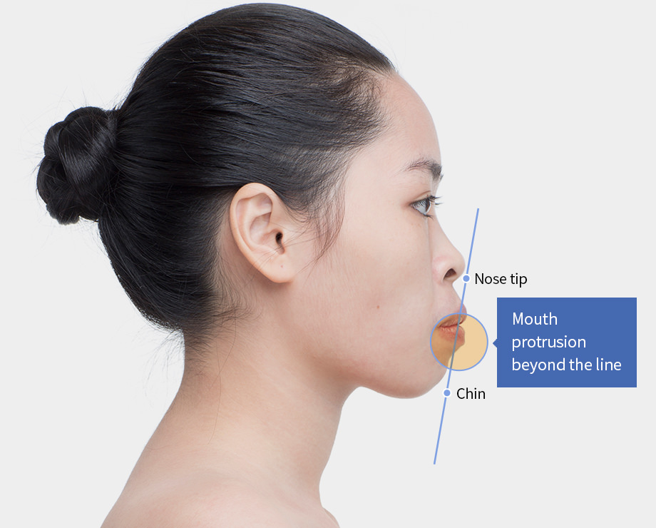 92DB3AA9 E71F 42DC B6E9 D9910D645A8E