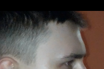 Xd2
