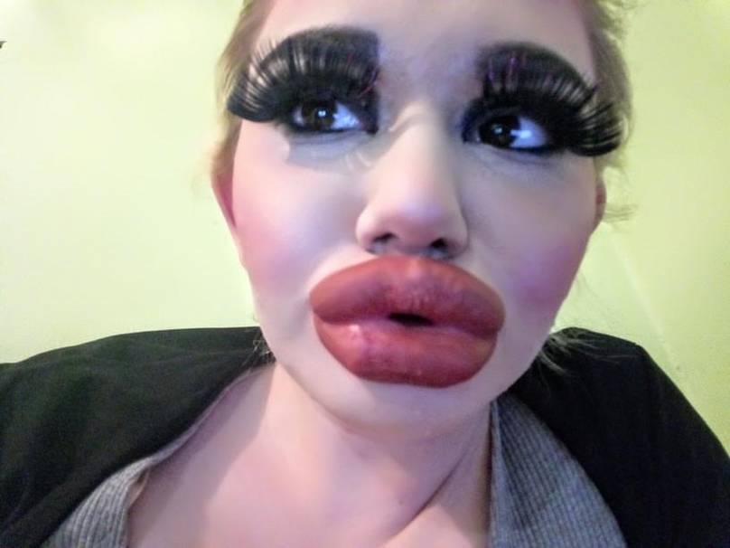 Thumbnail