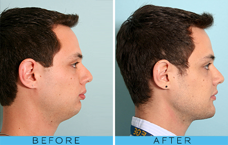 892EAA0D 628A 40A0 9B2C A70E788B29E8