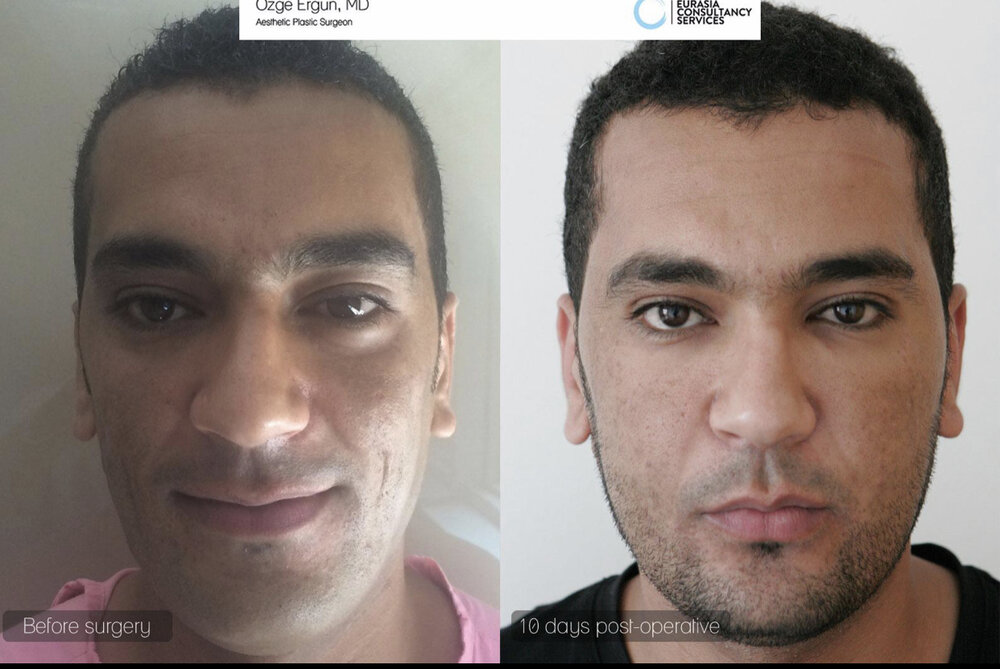 AADD2035 CD37 4448 87A4 BC81AB821719