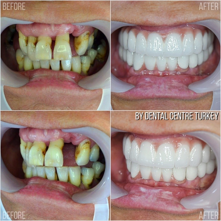 B6EA8C25 4CE9 4560 8529 0291F5C4F550