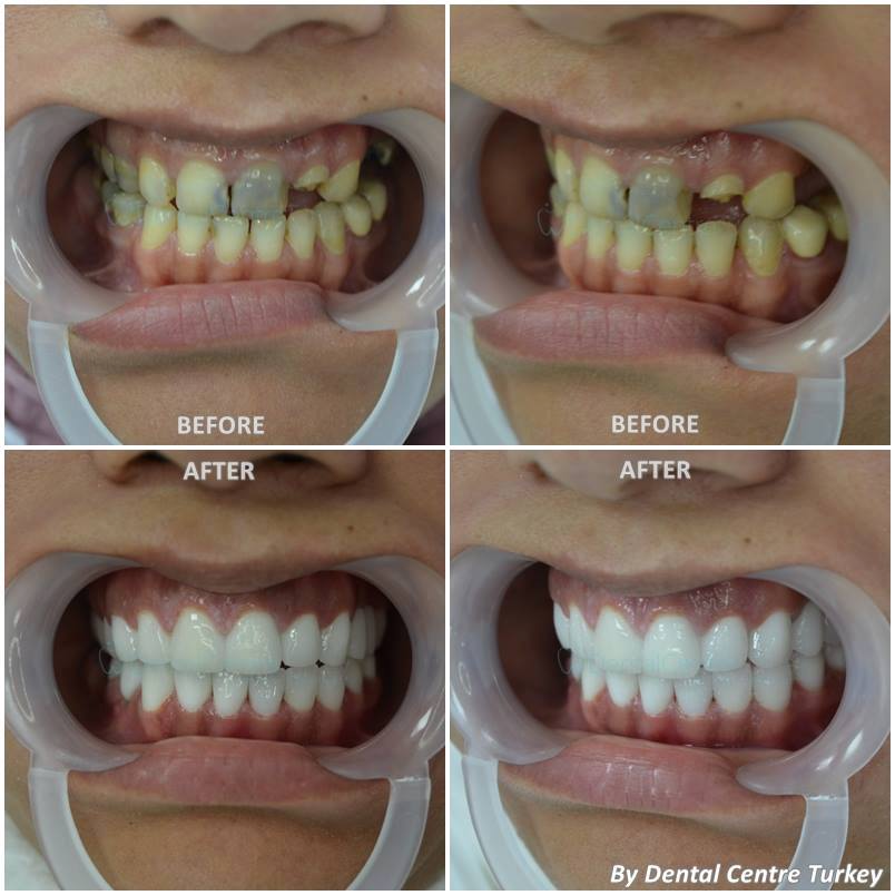 457272CF 4F96 4350 A72A AC369ADB8FBE