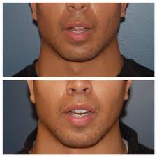 F30663CB 1511 42CD ADA9 89C37B129E39