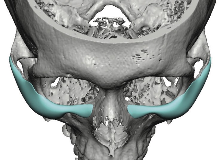 Saiyan ct birds eye view