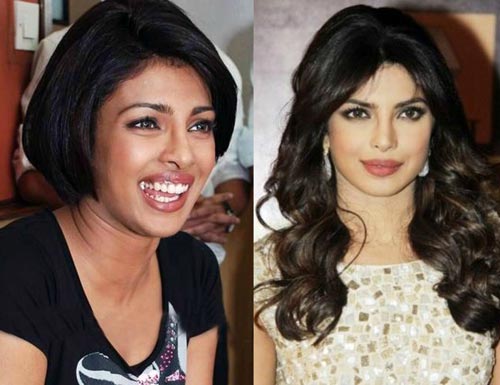 Best Bollywood Celebrity Who underwent skin lightening whitening treatment Priyanka Chopra