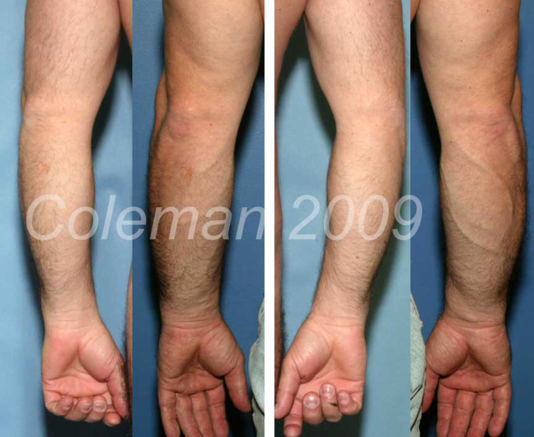 2B570A50 58E4 4A65 973A B93DB6B8B092