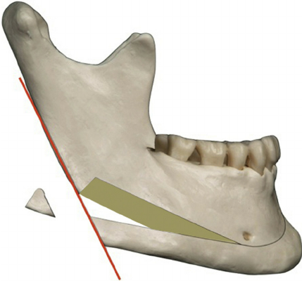 5D7AA6DF 9D5C 4E82 ACE6 D004515DDFD8