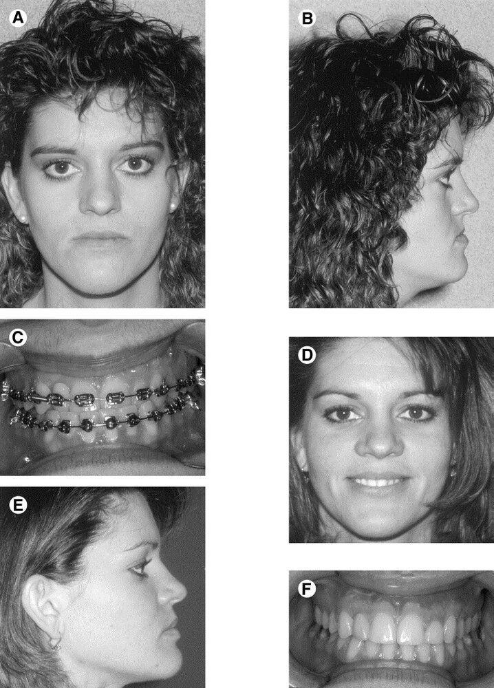 1 s20 S0278239104003969 gr3a