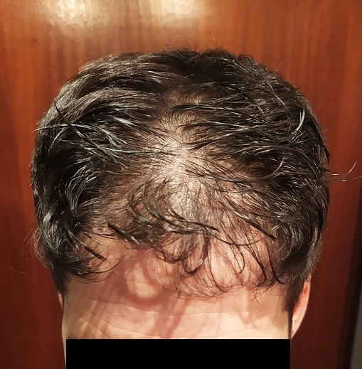 IMG 20200817 194802