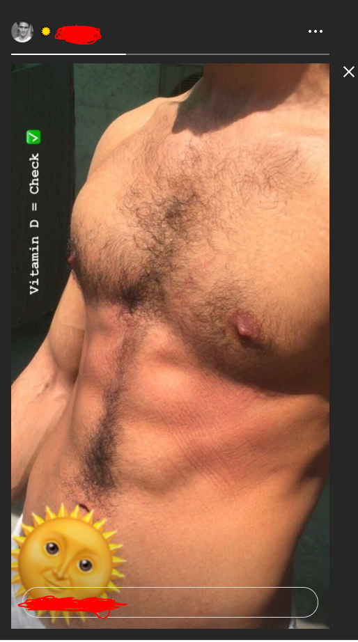 17 Body
