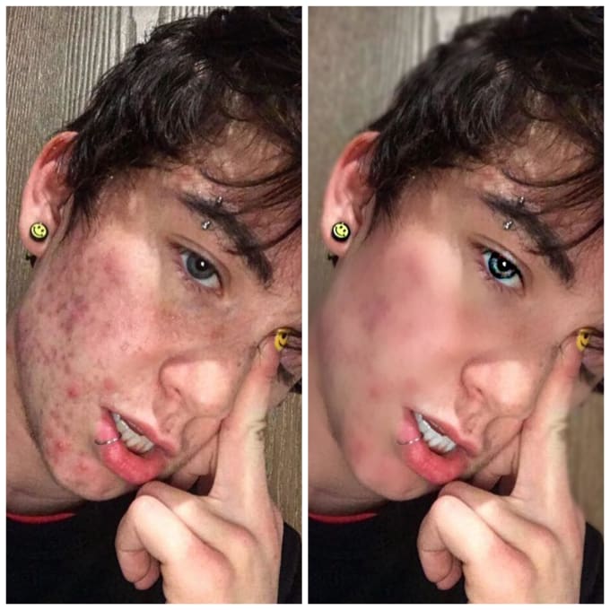 Skin touch up photo edit