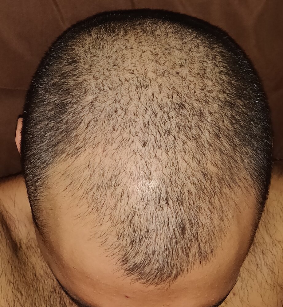 IMG 20200827 160054  01