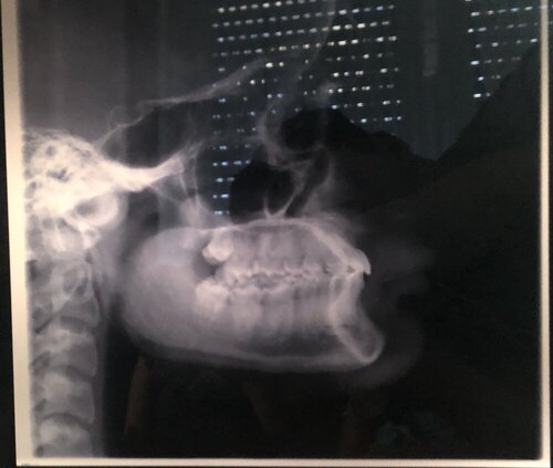 B2AB9891 DEED 40ED A931 591346F4D917